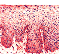 Normal cells